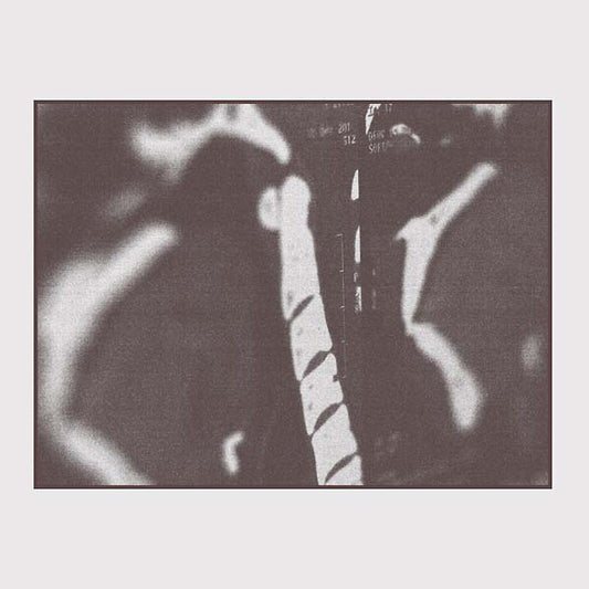 MRI | Get Cheap Vinyl